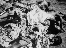 Unfortunate souls, victims of famine, disease, or some other cause. In India.  Scenes in India witnessed by American GIs during WWII. For many Americans of that era, with their limited experience traveling, the everyday sights and sounds overseas were new, intriguing, and photo worthy.