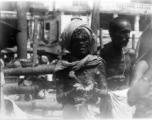 Man disfigured by skin disease.  Scenes in India witnessed by American GIs during WWII. For many Americans of that era, with their limited experience traveling, the everyday sights and sounds overseas were new, intriguing, and photo worthy.